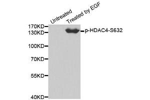 Western blot analysis of extracts from 293 cells using Phospho-HDAC4-S632 antibody (ABIN2988040). (HDAC4 Antikörper  (pSer632))