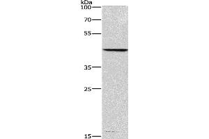 Western blot analysis of Hela cell, using BGN Polyclonal Antibody at dilution of 1:550 (Biglycan Antikörper)