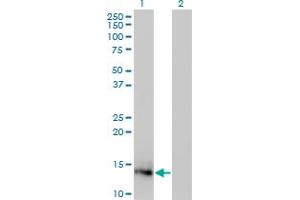 Western Blot analysis of IL2 expression in transfected 293T cell line by IL2 monoclonal antibody (M12), clone 1C1. (IL-2 Antikörper  (AA 21-153))