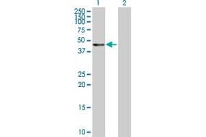 Western Blot analysis of KRT20 expression in transfected 293T cell line by KRT20 MaxPab polyclonal antibody. (KRT20 Antikörper  (AA 1-424))