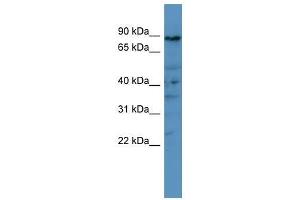 PDE8A antibody used at 0. (PDE8A Antikörper  (C-Term))