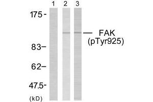 Western blot analysis of extracts using FAK (phospho- Tyr925) antibody (E011123). (FAK Antikörper  (pTyr925))