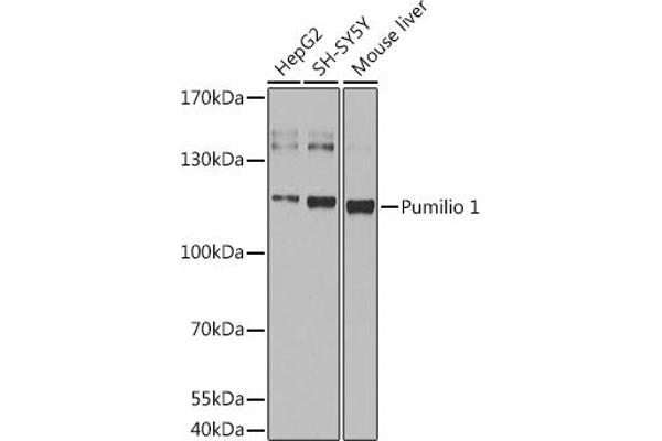 PUM1 Antikörper  (AA 1-130)