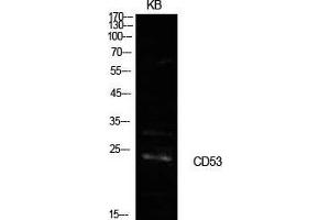 Western Blot (WB) analysis of KB cells using CD53 Polyclonal Antibody. (CD53 Antikörper  (Internal Region))