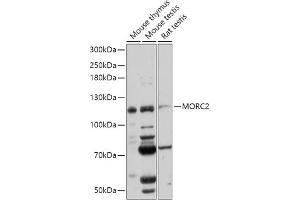 Western blot analysis of extracts of various cell lines, using MORC2 antibody (ABIN7268683) at 1:1000 dilution. (MORC2 Antikörper  (AA 60-250))