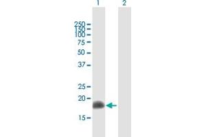 Western Blot analysis of ARL2 expression in transfected 293T cell line by ARL2 MaxPab polyclonal antibody. (ARL2 Antikörper  (AA 1-184))