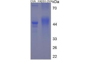 Image no. 1 for Fatty Acid Desaturase 1 (FADS1) (AA 25-37) peptide (Ovalbumin) (ABIN5666166) (Fatty Acid Desaturase 1 (FADS1) (AA 25-37) peptide (Ovalbumin))