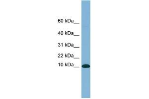 WB Suggested Anti-B2M Antibody Titration: 0. (beta-2 Microglobulin Antikörper  (N-Term))