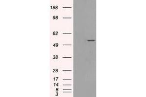 Western Blotting (WB) image for anti-Solute Carrier Family 2 (Facilitated Glucose/fructose Transporter), Member 5 (SLC2A5) antibody (ABIN1498476) (SLC2A5 Antikörper)