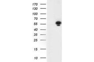 HEK293T cells were transfected with the pCMV6-ENTRY control (Left lane) or pCMV6-ENTRY TP53 (Right lane) cDNA for 48 hrs and lysed. (p53 Antikörper)