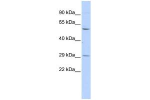 WB Suggested Anti-TRIM62 Antibody Titration:  0. (TRIM62 Antikörper  (Middle Region))