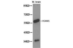Western Blotting (WB) image for anti-Vascular Cell Adhesion Molecule 1 (VCAM1) antibody (ABIN1875313) (VCAM1 Antikörper)