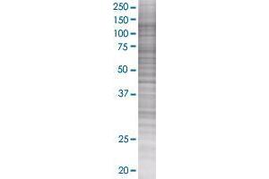 SNX19 transfected lysate. (SNX19 293T Cell Transient Overexpression Lysate(Denatured))