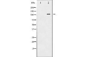 Western blot analysis of ATP1 alpha1/Na+K+ ATPase1 phosphorylation expression in Rat brain tissue lysates,The lane on the left is treated with the antigen-specific peptide. (ATP1A1 Antikörper  (pSer23))