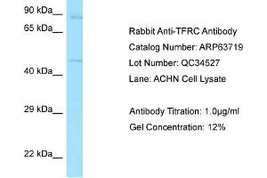 Western Blotting (WB) image for anti-Transferrin Receptor (p90, CD71) (TFRC) (N-Term) antibody (ABIN971871) (Transferrin Receptor Antikörper  (N-Term))