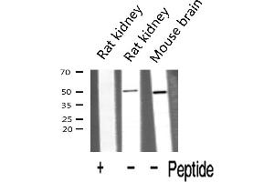 Western blot analysis of HDAC3 expression in various lysates (HDAC3 Antikörper  (C-Term))