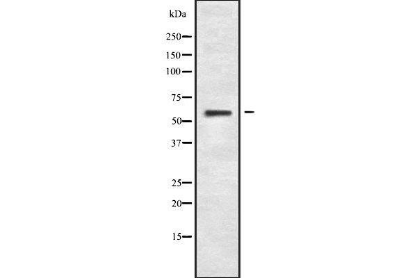 SLC16A6 Antikörper