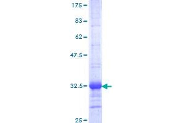 IRX1 Protein (AA 424-479) (GST tag)