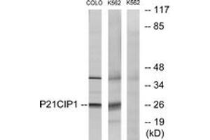 Western blot analysis of extracts from COLO/K562 cells, treated with EGF, using p21 Cip1 (Ab-145) Antibody. (p21 Antikörper  (AA 111-160))