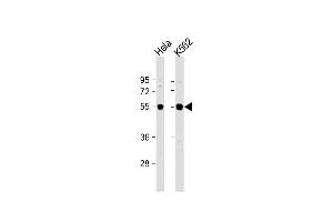 All lanes : Anti-IRAK4 Antibody (N-term) at 1:1000 dilution Lane 1: Hela whole cell lysate Lane 2: K562 whole cell lysate Lysates/proteins at 20 μg per lane. (IRAK4 Antikörper  (N-Term))