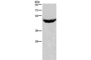 Western Blotting (WB) image for anti-Chemokine (C-X-C Motif) Receptor 2 (CXCR2) antibody (ABIN2431222) (CXCR2 Antikörper)