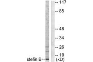 Western Blotting (WB) image for anti-Cystatin B (Stefin B) (CSTB) (AA 49-98) antibody (ABIN2889258) (CSTB Antikörper  (AA 49-98))