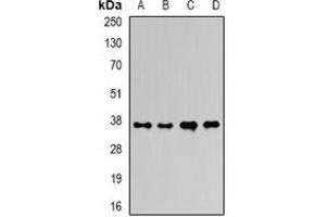 Western blot analysis of Ficolin 1 expression in HepG2 (A), mouse liver (B), mouse heart (C), rat liver (D) whole cell lysates. (FCN1 Antikörper)