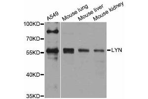 Western blot analysis of extracts of various cell lines, using Lyn antibody (ABIN4904272) at 1:1000 dilution. (LYN Antikörper)