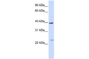 WB Suggested Anti-ACADL Antibody Titration:  0. (ACADL Antikörper  (Middle Region))