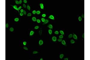 Immunofluorescence staining of Hela cells with ABIN7139604 at 1:2. (HIST1H4A Antikörper  (meLys5))