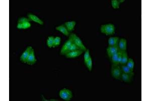 Immunofluorescent analysis of HepG2 cells using ABIN7173954 at dilution of 1:100 and Alexa Fluor 488-congugated AffiniPure Goat Anti-Rabbit IgG(H+L) (INPP5A Antikörper  (AA 1-409))