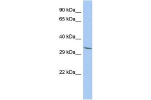 WB Suggested Anti-FAM78A Antibody Titration: 0. (FAM78A Antikörper  (N-Term))