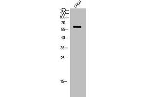 Western Blot analysis of COLO cells using Phospho-c-Src (S75) Polyclonal Antibody (Src Antikörper  (pSer75))