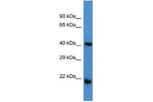 Host:  Rabbit  Target Name:  RGS7  Sample Type:  Jurkat Whole cell lysates  Antibody Dilution:  1. (RGS7 Antikörper  (N-Term))