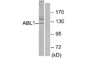 Immunohistochemistry analysis of paraffin-embedded human brain tissue using ABL1 antibody. (ABL1 Antikörper  (Internal Region))