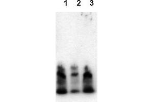 Western Blotting (WB) image for anti-Amyloid beta (Abeta) (N-Term) antibody (ABIN126730) (beta Amyloid Antikörper  (N-Term))