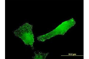 Immunofluorescence of monoclonal antibody to SH2D3C on HeLa cell. (SH2D3C Antikörper  (AA 1-110))