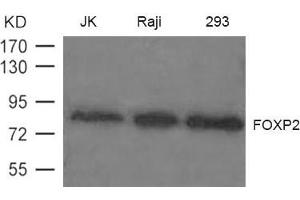 Western blot analysis of extract from JK, Raji and 293 cells using FOXP2 Antibody (FOXP2 Antikörper)