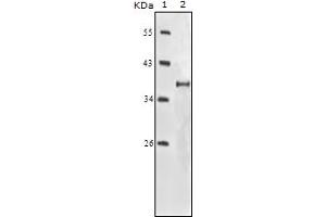 Western Blotting (WB) image for anti-Insulin-Like Growth Factor 1 Receptor (IGF1R) (truncated) antibody (ABIN2464067) (IGF1R Antikörper  (truncated))