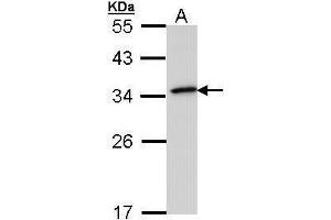 WB Image Sample (30 ug of whole cell lysate) A: 293T 12% SDS PAGE antibody diluted at 1:1000 (NQO1 Antikörper  (Center))