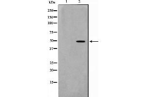 NEUROD2 Antikörper  (Internal Region)