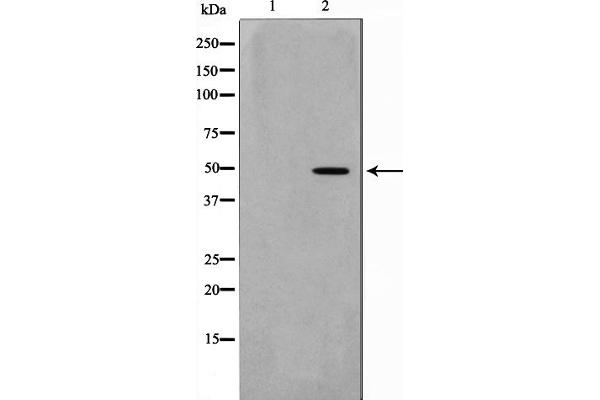 NEUROD2 Antikörper  (Internal Region)