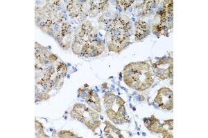 Immunohistochemistry of paraffin-embedded human stomach using PPOX antibody (ABIN5973799) at dilution of 1/100 (40x lens). (PPOX Antikörper)