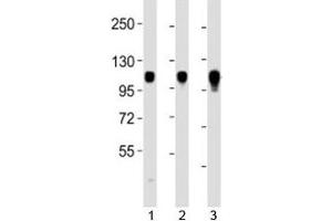 Western blot testing of Integrin alpha 7 antibody at 1:2000 dilution. (ITGA7 Antikörper  (C-Term))