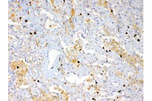 IHC analysis of Psoriasin using anti-Psoriasin antibody . (S100A7 Antikörper  (AA 2-101))