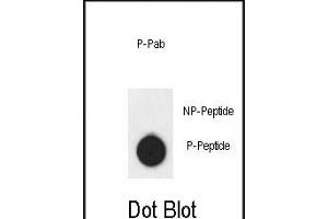 Dot blot analysis of anti-AKT1- Phospho-specific Pab (ABIN6241037 and ABIN6578932) on nitrocellulose membrane. (AKT1 Antikörper  (pSer124))
