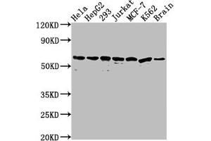 Western Blot Positive WB detected in: Hela whole cell lysate, HepG2 whole cell lysate, 293 whole cell lysate, Jurkat whole cell lysate, MCF-7 whole cell lysate, K562 whole cell lysate, Mouse brain tissue All lanes: HSPD1 antibody at 1:2000 Secondary Goat polyclonal to rabbit IgG at 1/50000 dilution Predicted band size: 62, 18 kDa Observed band size: 60 kDa (Rekombinanter HSPD1 Antikörper)