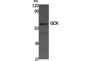 Western Blotting (WB) image for anti-Glucokinase (Hexokinase 4) (GCK) antibody (ABIN5961047) (GCK Antikörper)