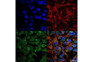 Immunocytochemistry/Immunofluorescence analysis using Rabbit Anti-BDNF Polyclonal Antibody . (BDNF Antikörper  (N-Term) (PerCP))