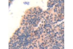 IHC-P analysis of Human Tissue, with DAB staining. (MYL12B Antikörper  (AA 5-172))